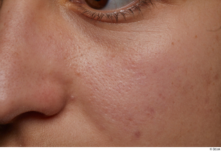 HD Face Skin Talitha Kudadiri cheek face nose skin pores…